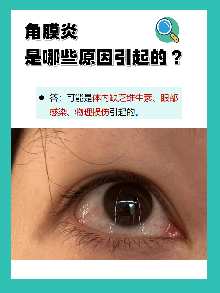 角膜炎是一种常见的眼部疾病,引起该疾病的原因有哪些呢?