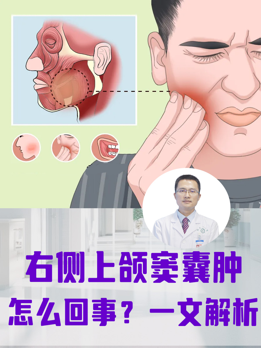 颌窦在哪个位置图片图片