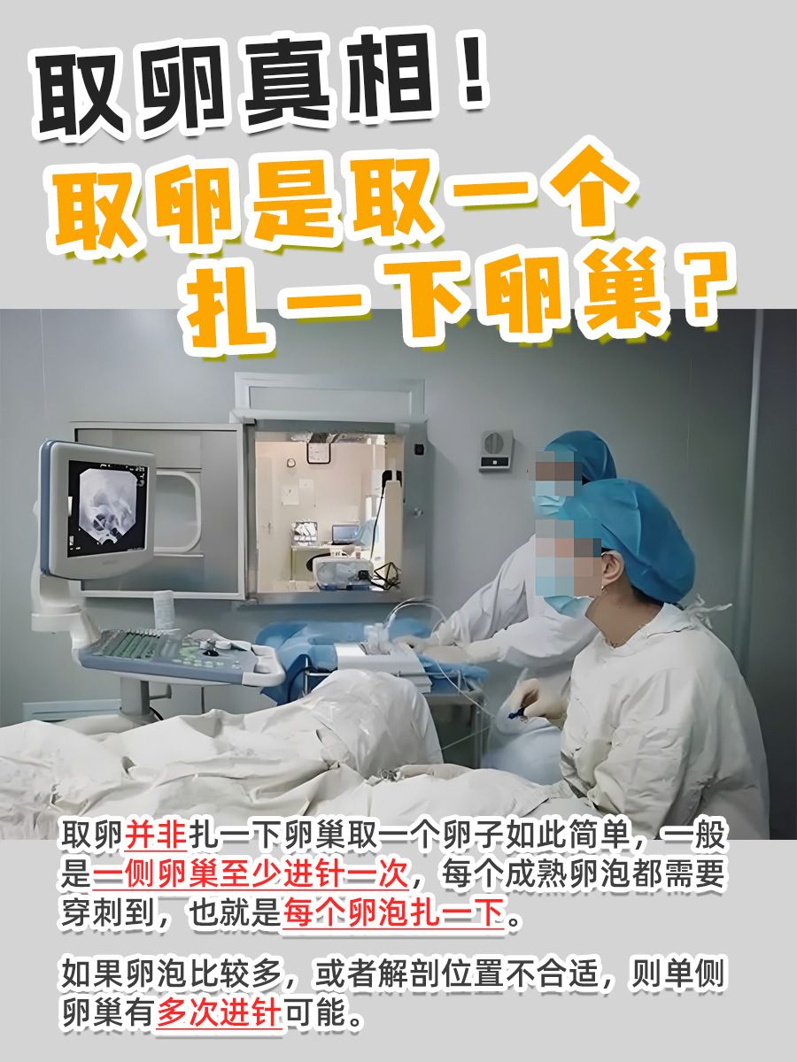 女人取卵子视频_女性取卵手术全部视频  第2张