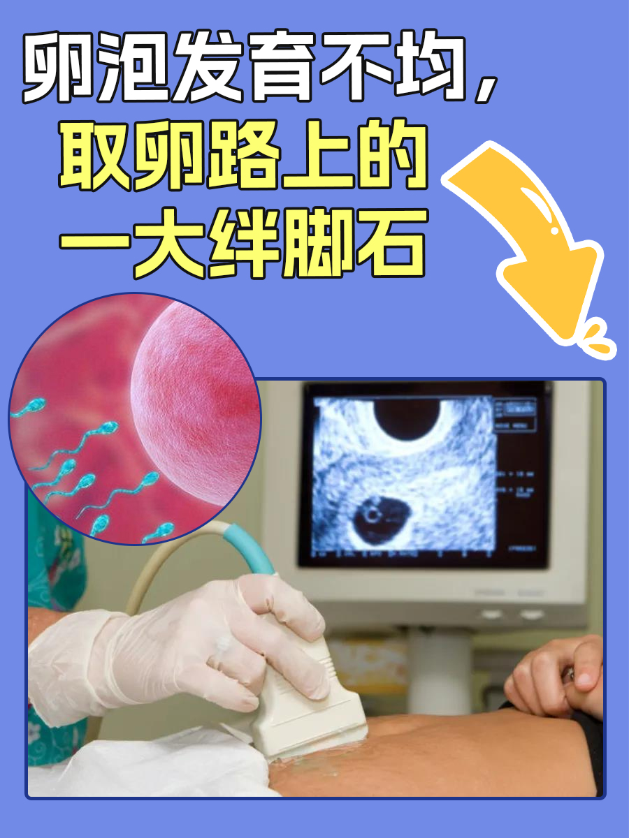 试管取卵子怎么取_试管婴儿取卵是怎么取出来的  第2张
