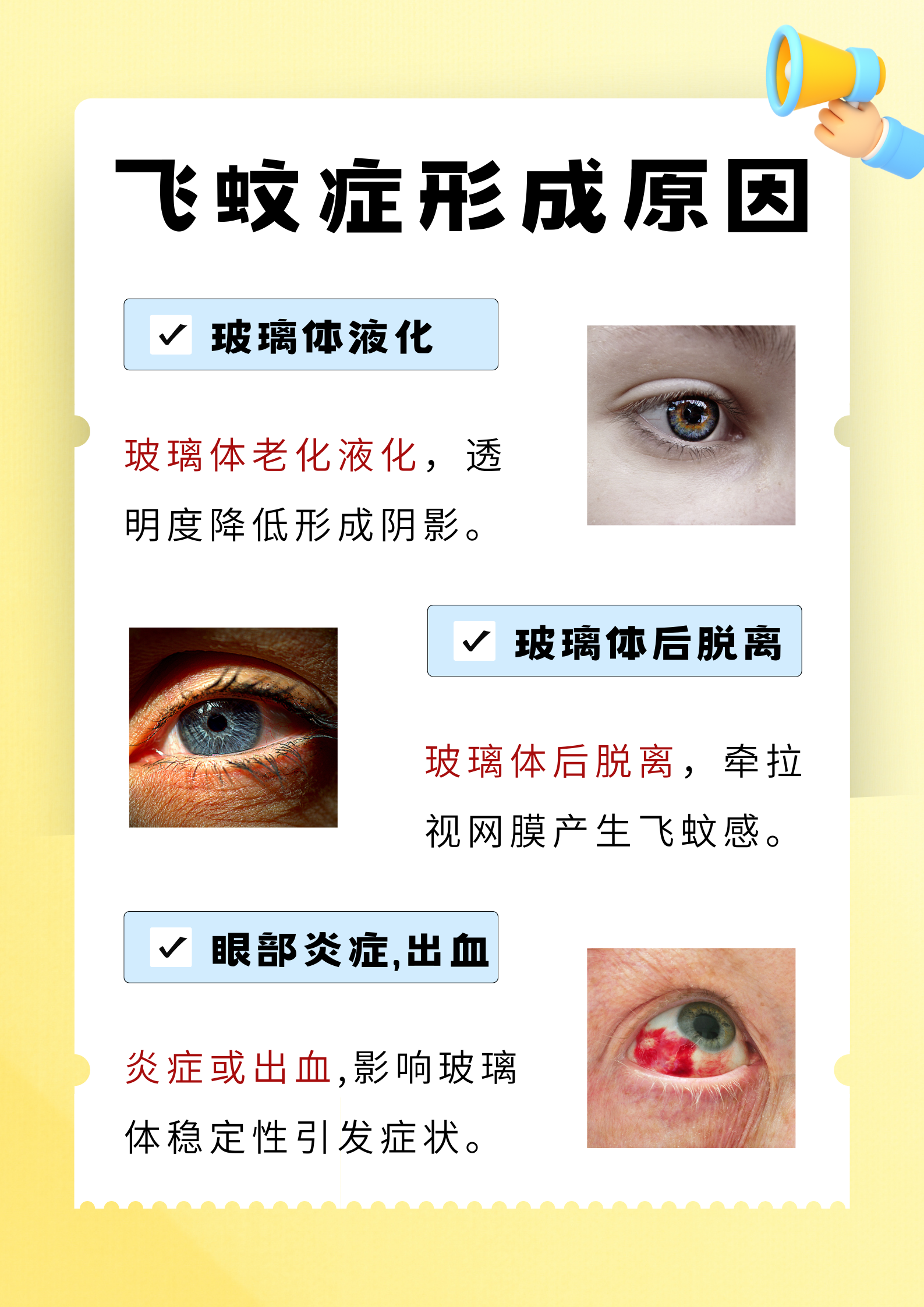 飞蚊症症状有眼前黑影飘动,像蚊子或线头