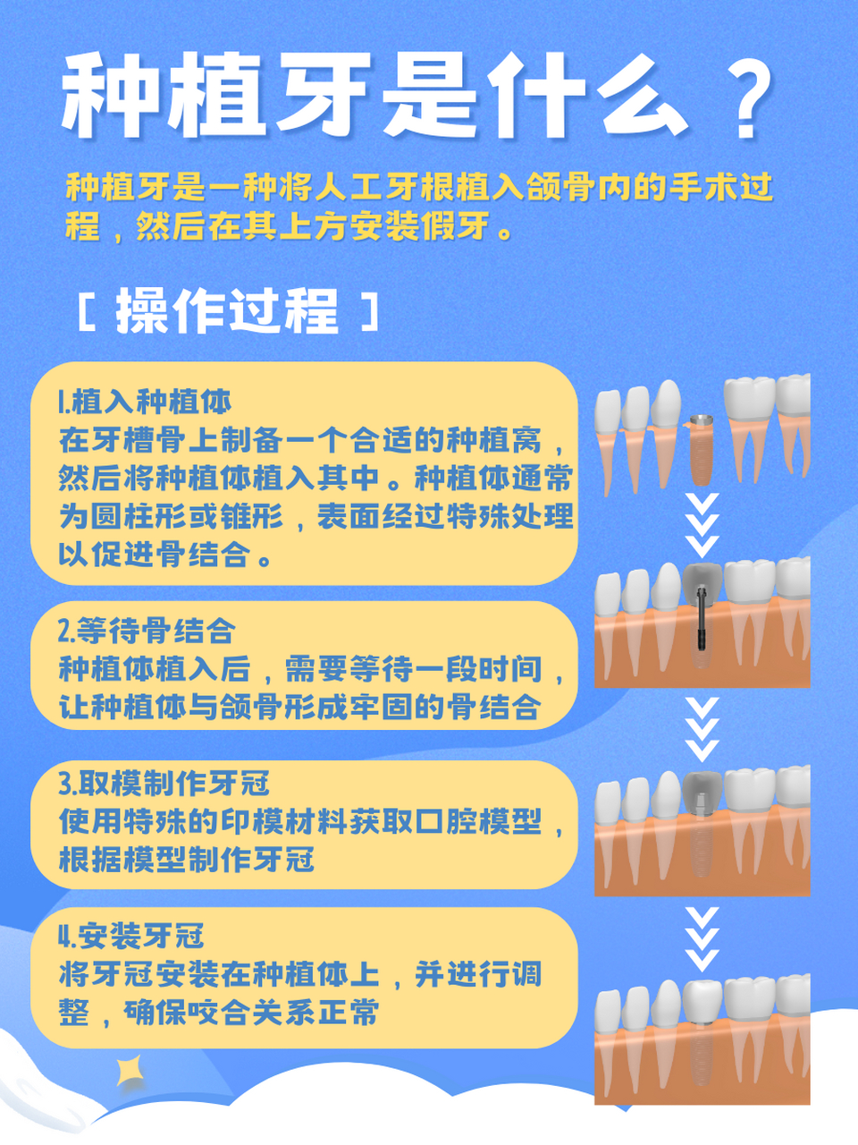 摘牙套的过程图解图片