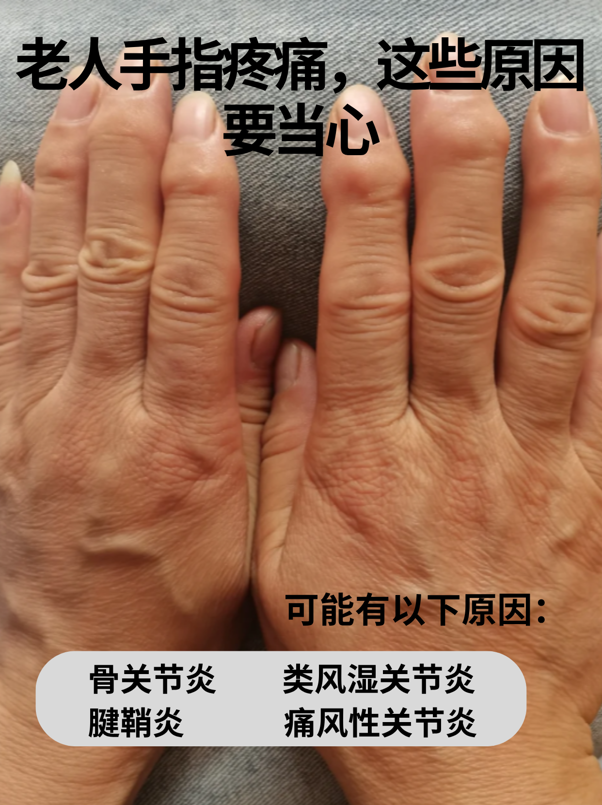 让长辈重获灵活双手～