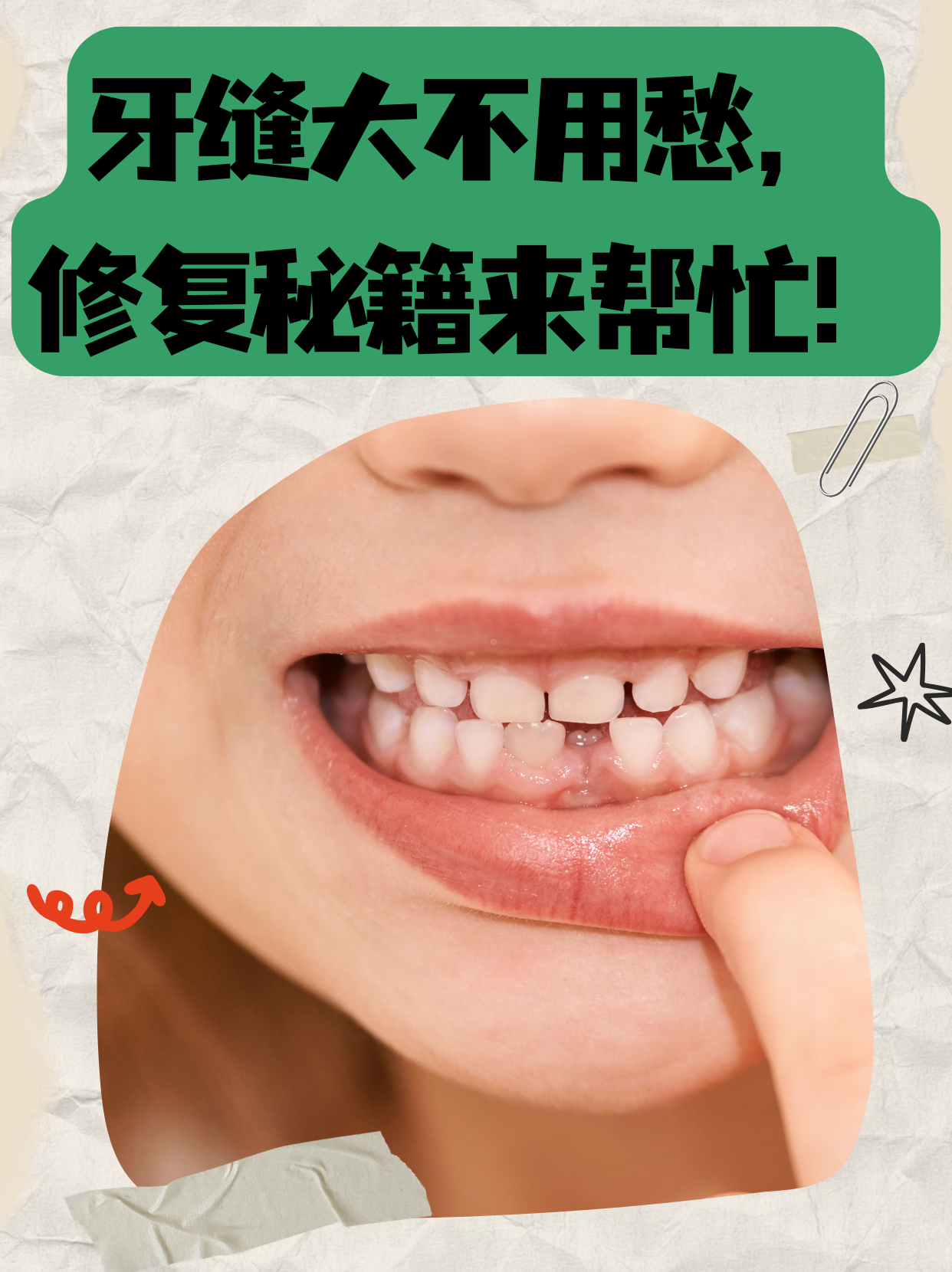 年龄大了为什么牙缝越来越大为什么在线 年龄大了为什么牙缝越来越大为什么在线