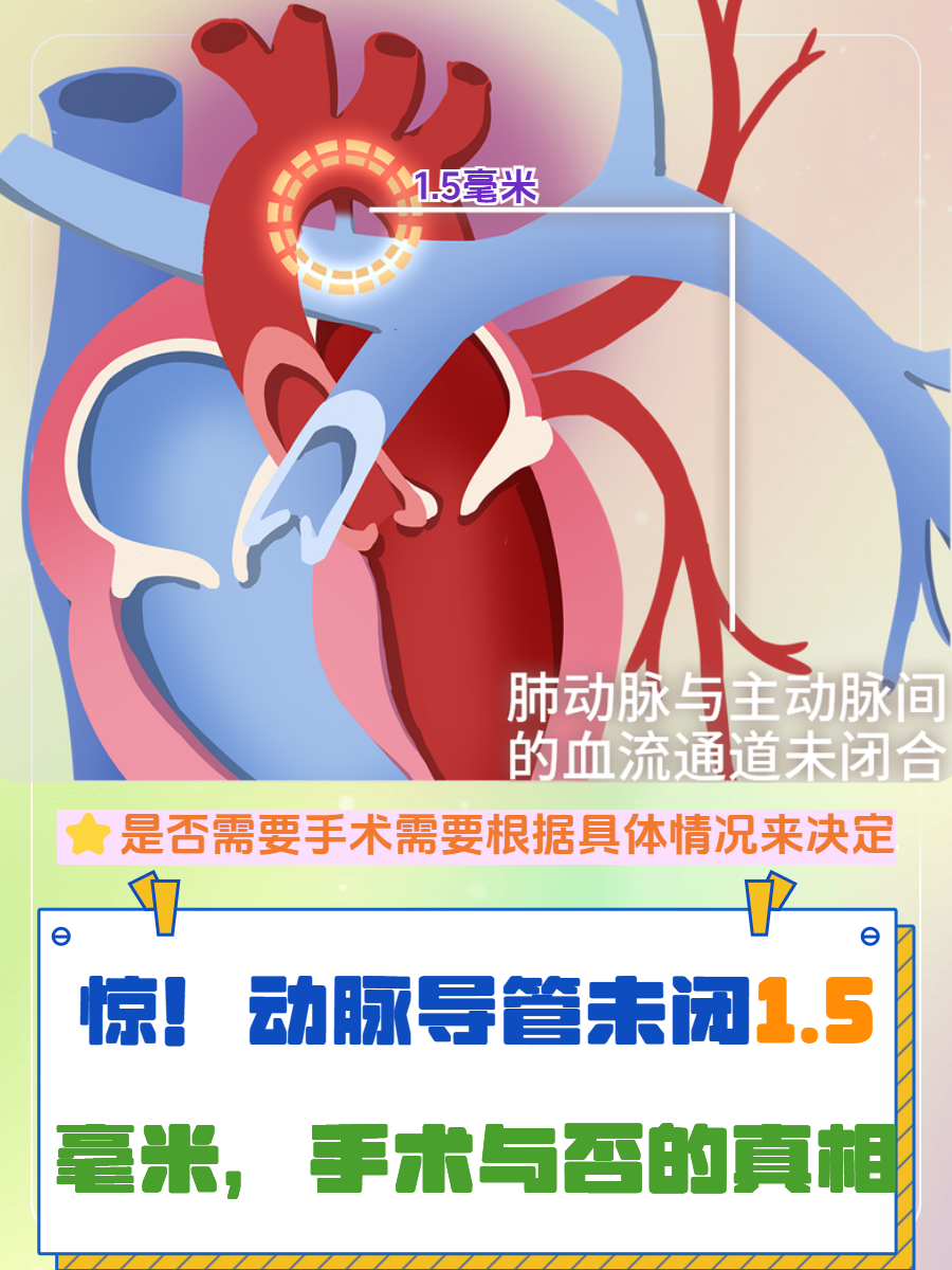 动脉导管未闭1.5毫米,手术与否的真相