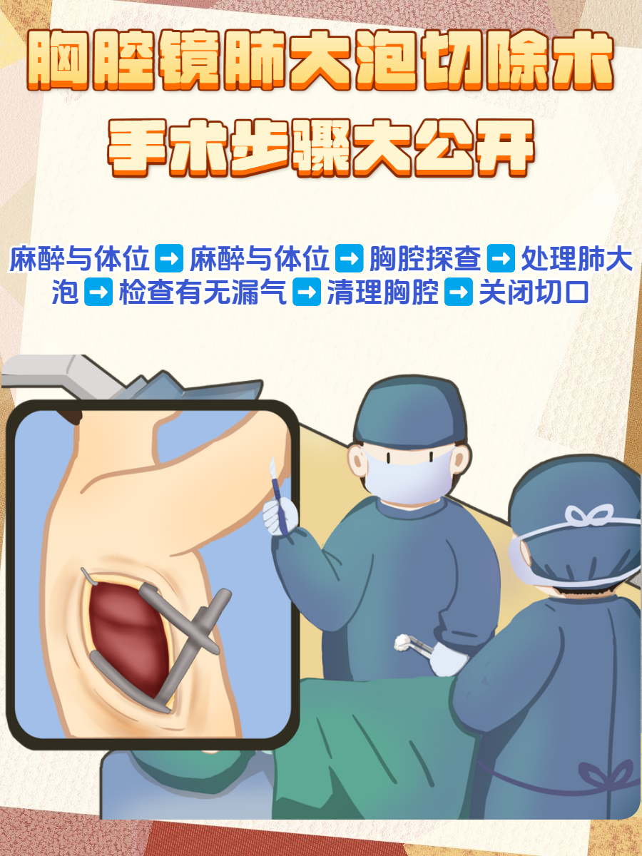 胸腔镜肺大泡切除术,手术步骤大公开