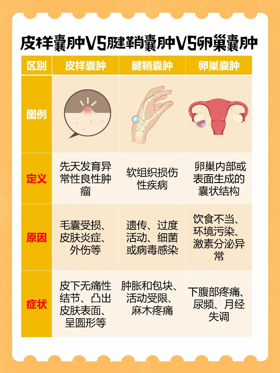 治疗囊肿最快有效的办法得看囊肿大小,位置和类型