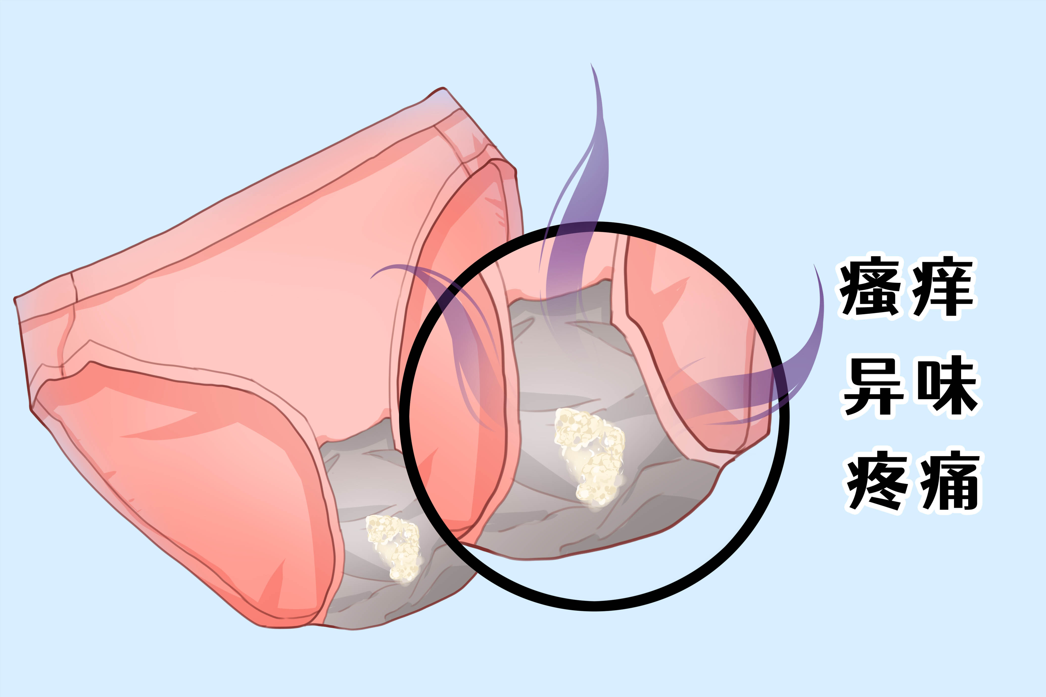 总感觉私密处老是瘙痒,白带也不正常