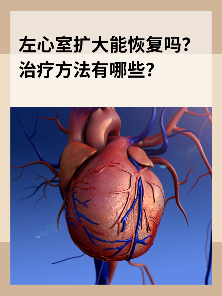 左心扩大是心脏疾病中常见的一种表现,它可能是由多种心脏问题引起