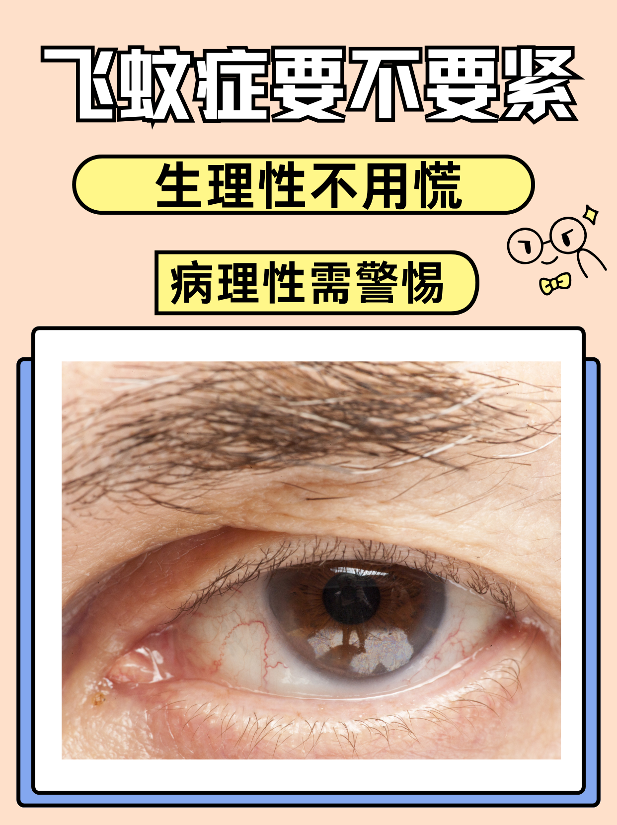 症早上6点过左右眼球有飞蚊症细菌痒飞蚊症图片飞蚊症图片早期照片