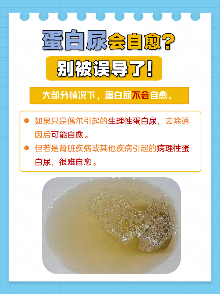 今天来聊聊蛋白尿这个话题,很多人对它一知半解,甚至还存在"蛋白尿