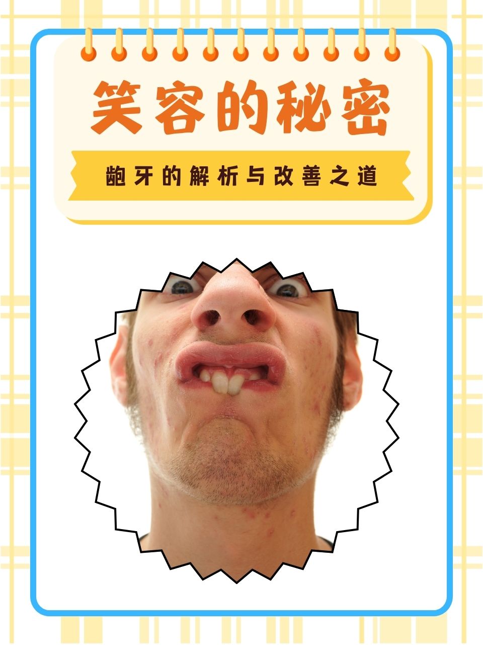 笑容的秘密:龅牙的解析与改善之道 龅牙,作为牙齿排列异常的一