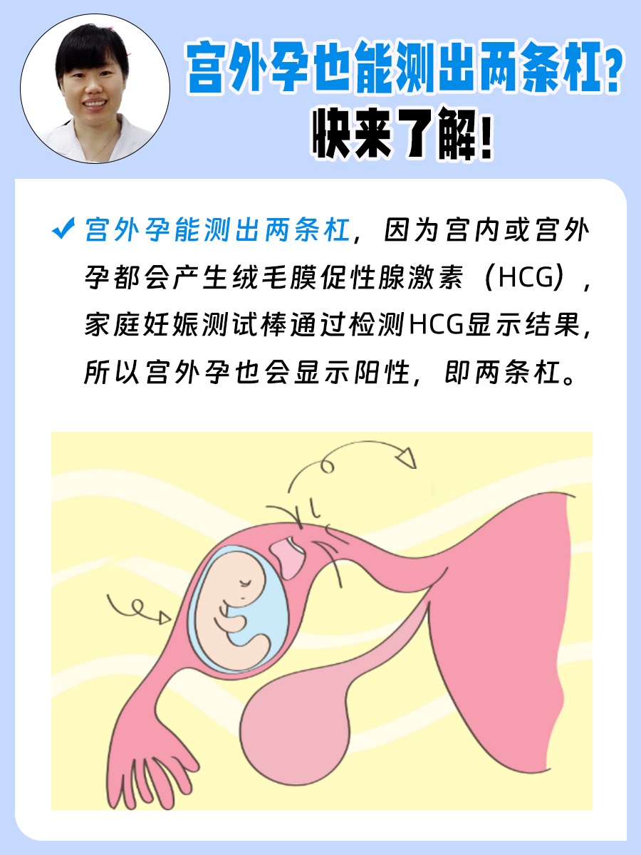 包含女人为什么会宫外怀孕的词条 包含女人为什么会宫外怀孕的词条