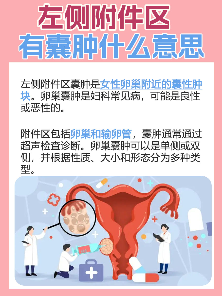 卵巢囊肿是女性常见的妇科疾病,可以是单纯的液体积聚,也可以是复杂的