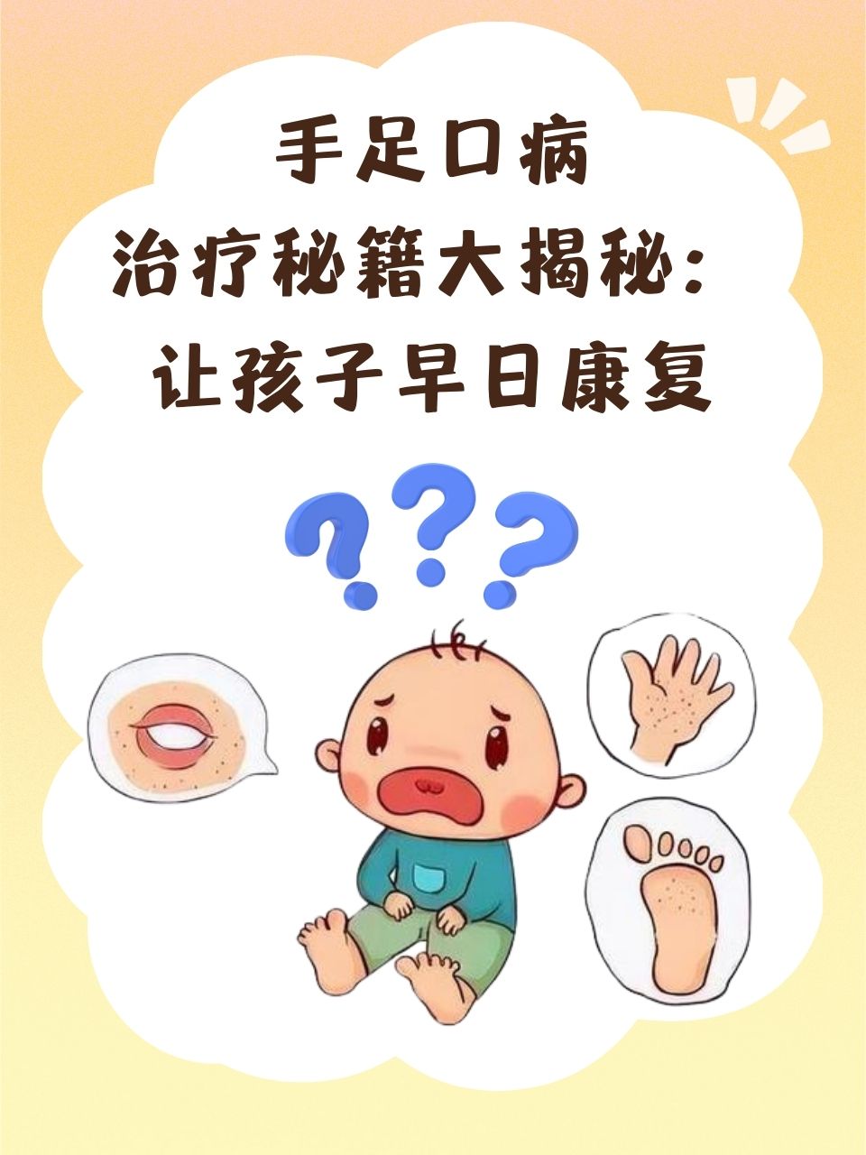 手足口病治疗秘籍大揭秘:让孩子早日康复