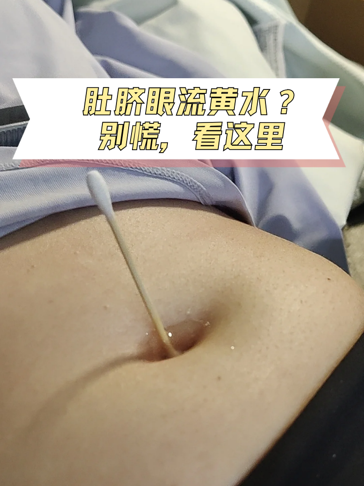 为什么肚脐眼里有脏东西不能抠为什么在线