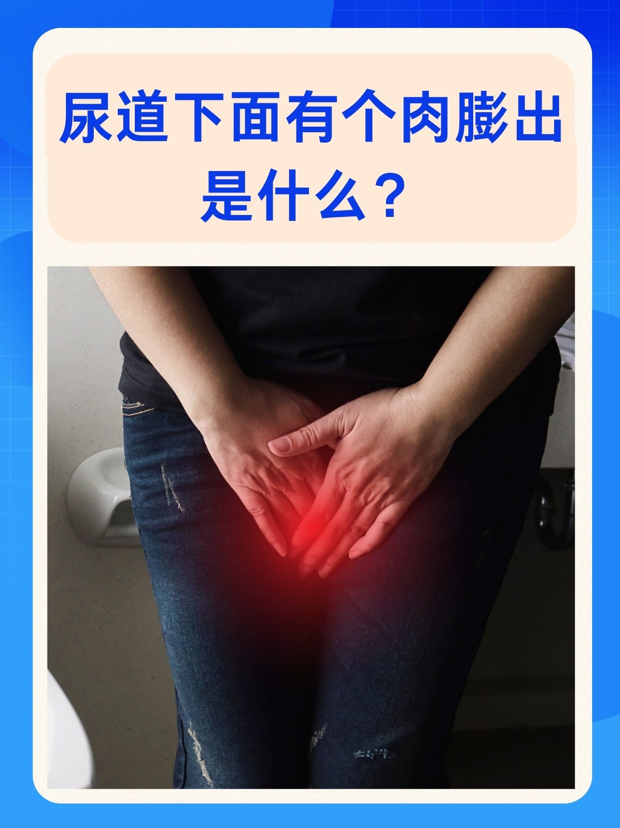 在日常生活中,有些人可能会发现尿道下面有个肉膨出的情况,这往往会