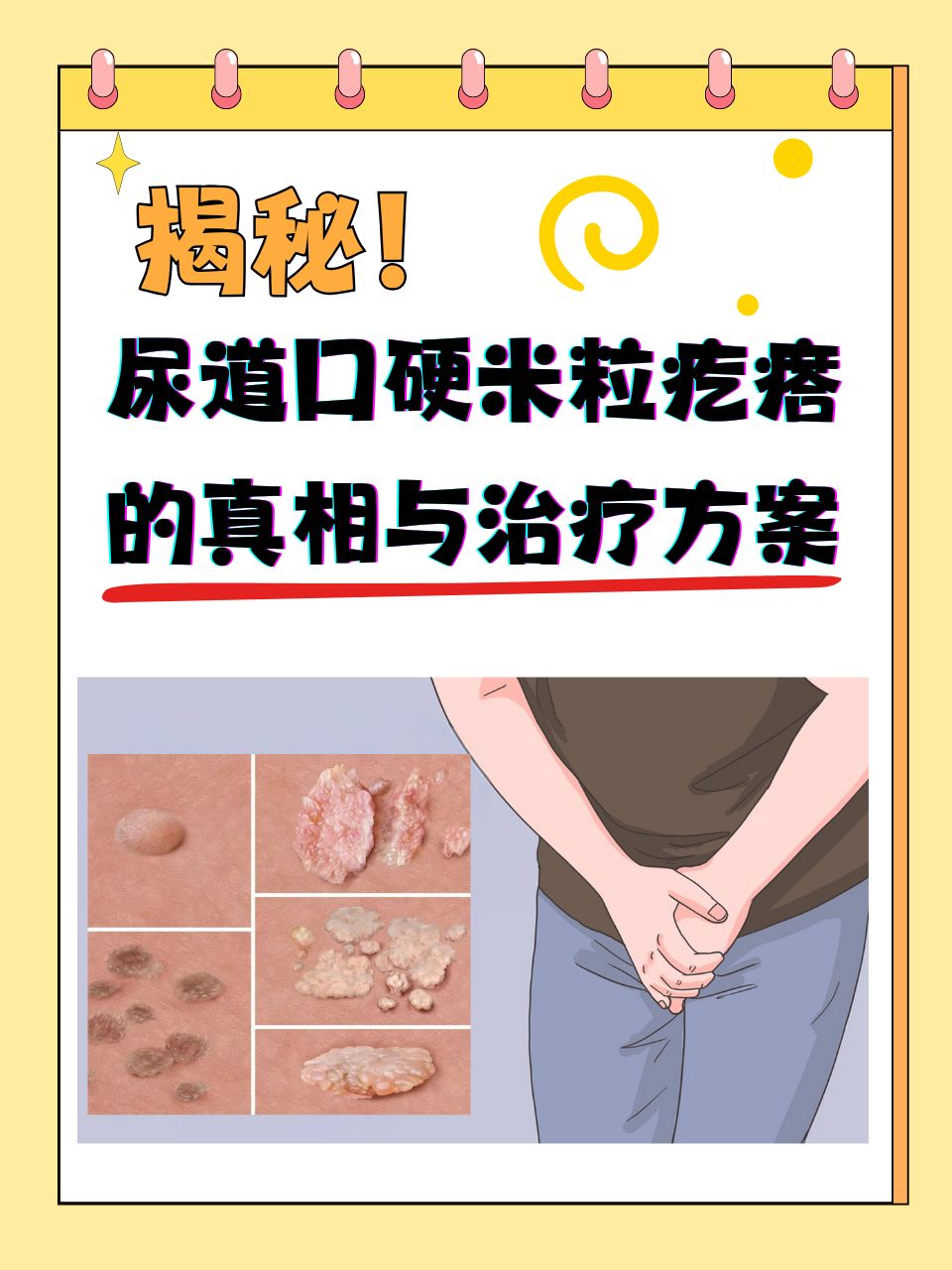 尿道口有小肉粒是怎么回事