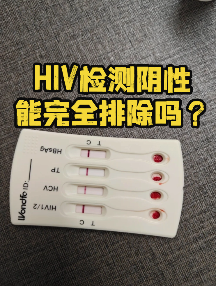 hiv检测阴性就能完全排除吗?