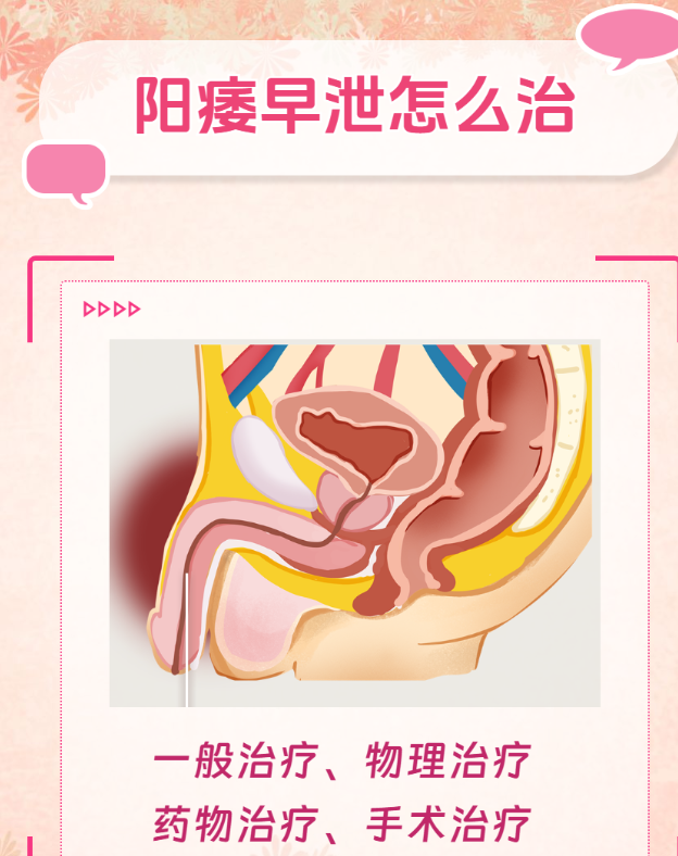 它受心理,生活习惯等因素影响,只要找对方法,积极治