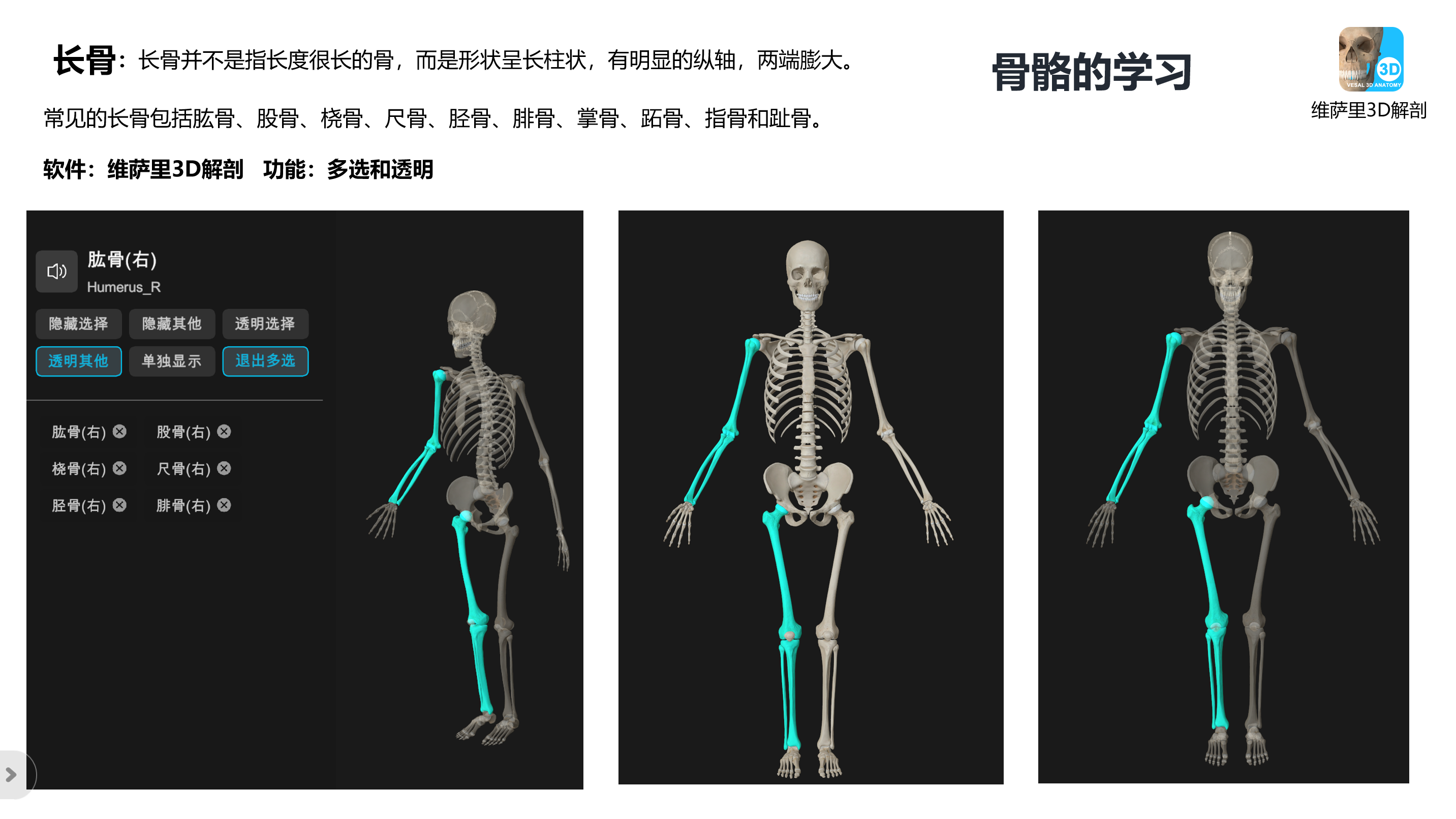 人体最长的骨图片