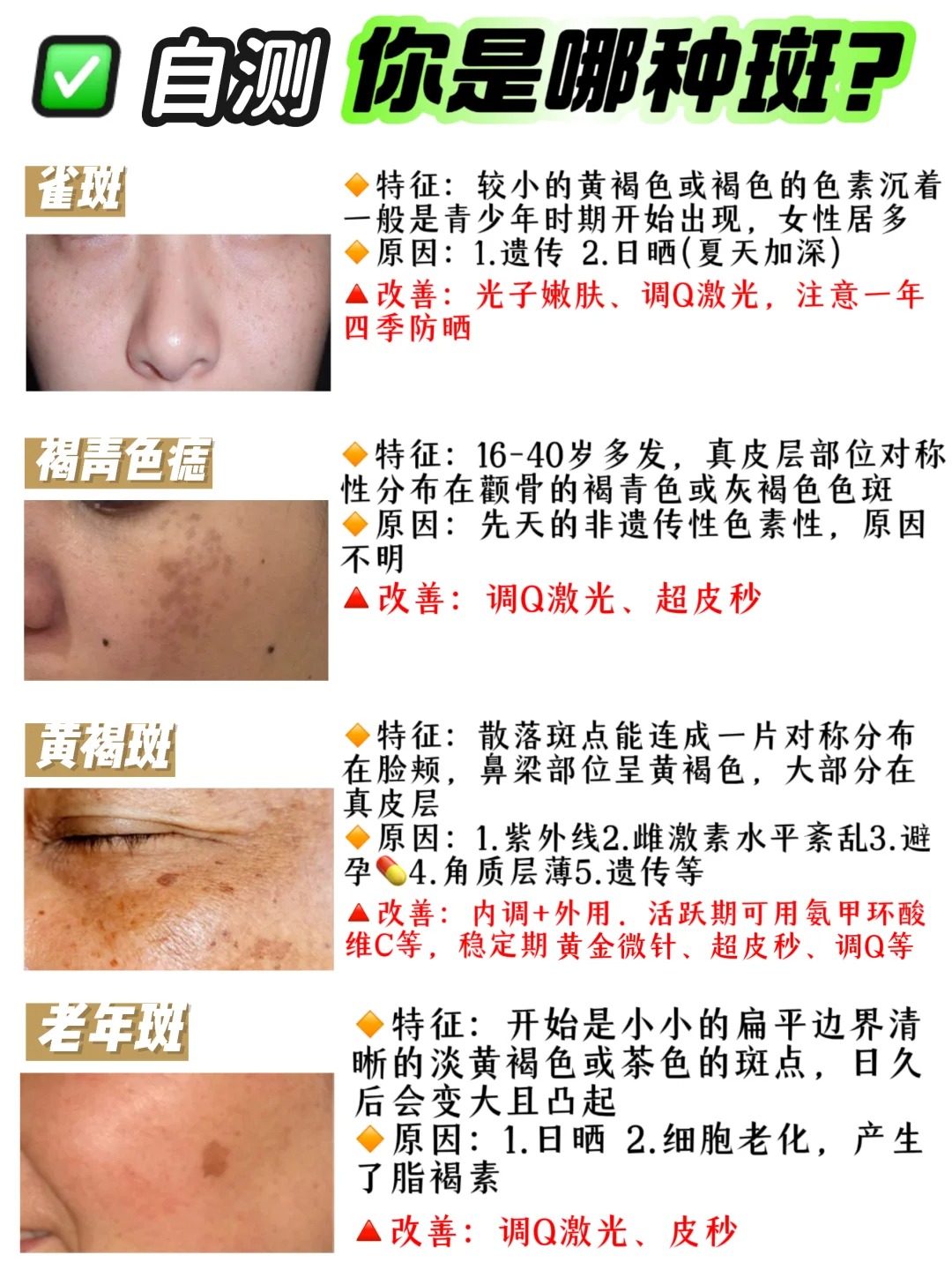 色斑除了有表层斑和真皮斑之分还有活性斑和定性斑的区分 	 上图已经