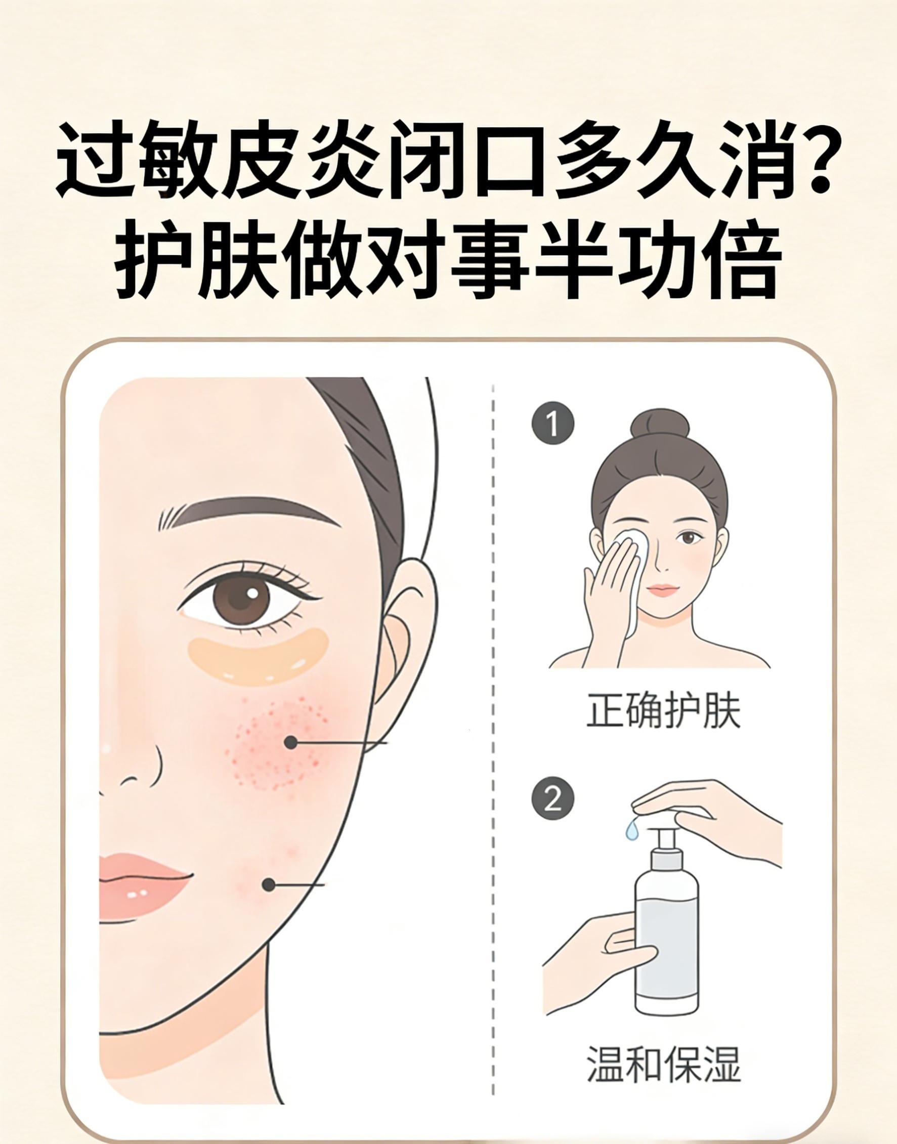 过敏皮炎闭口多久消?