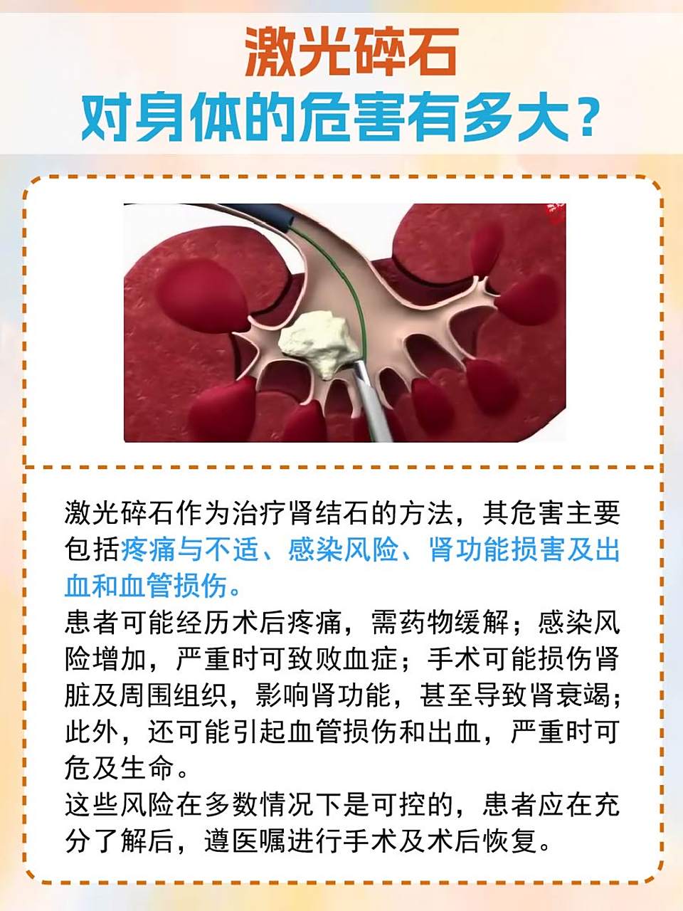 💡激光碎石作为一种常见的治疗肾结石的方法,虽然效果显著,但也