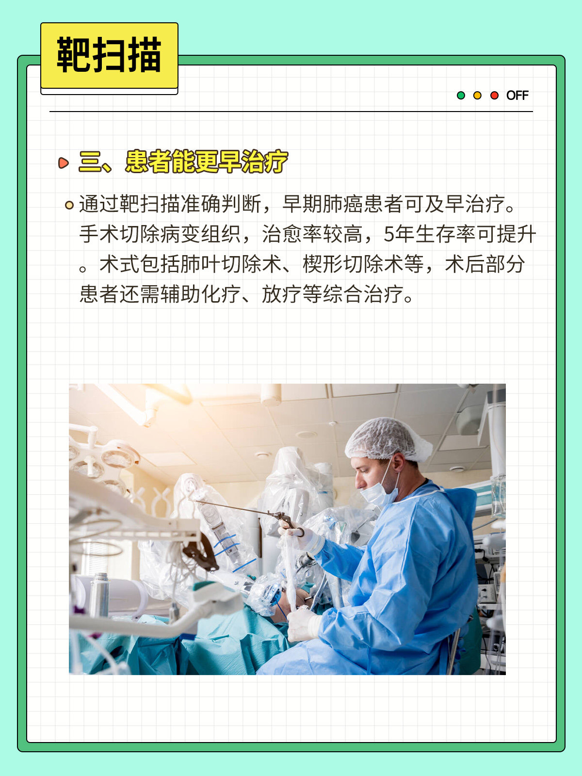 靶扫描准确判断让早期肺癌及早治疗