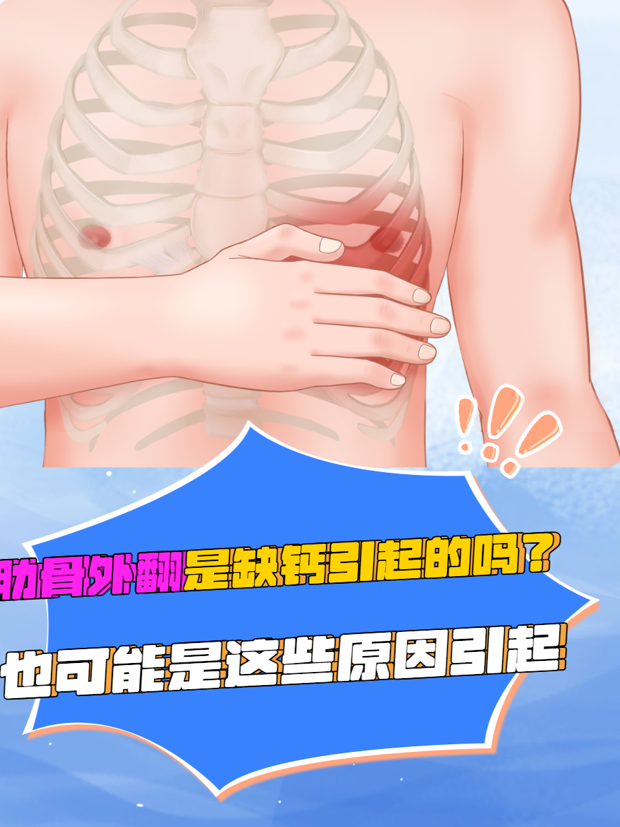 肋骨外翻是缺钙引起的吗?