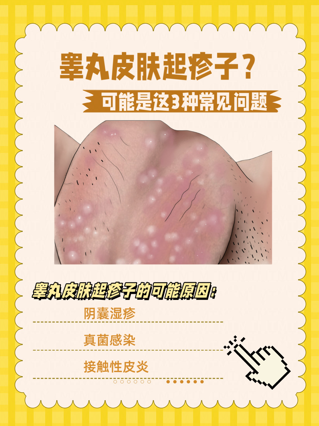 可能是这3种常见问题