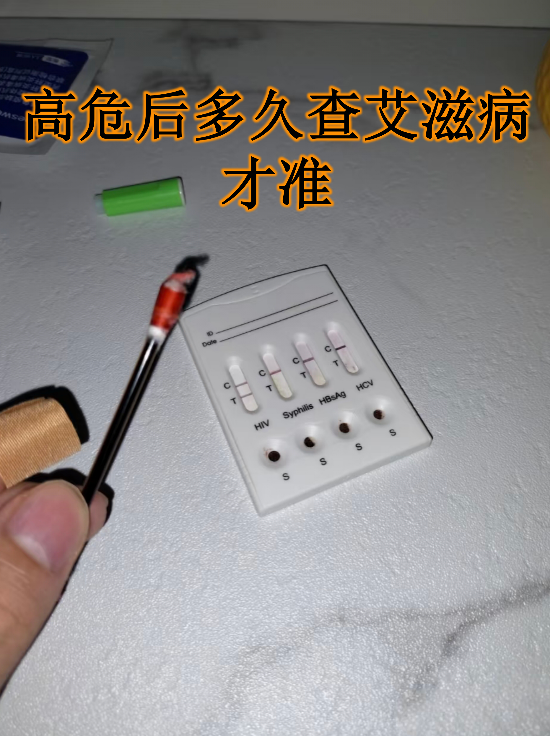 高危后多久查艾滋病才准