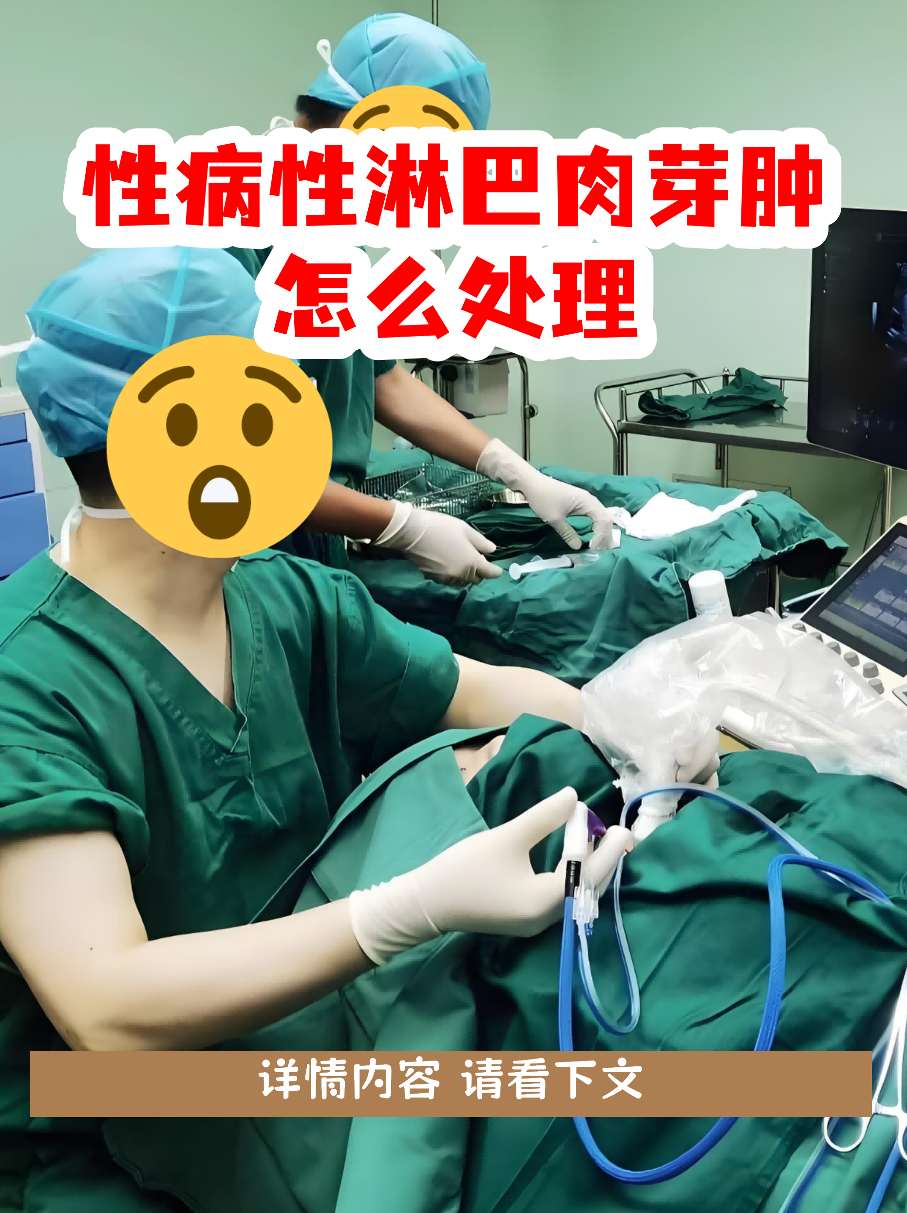 性病性淋巴肉芽肿怎么处理