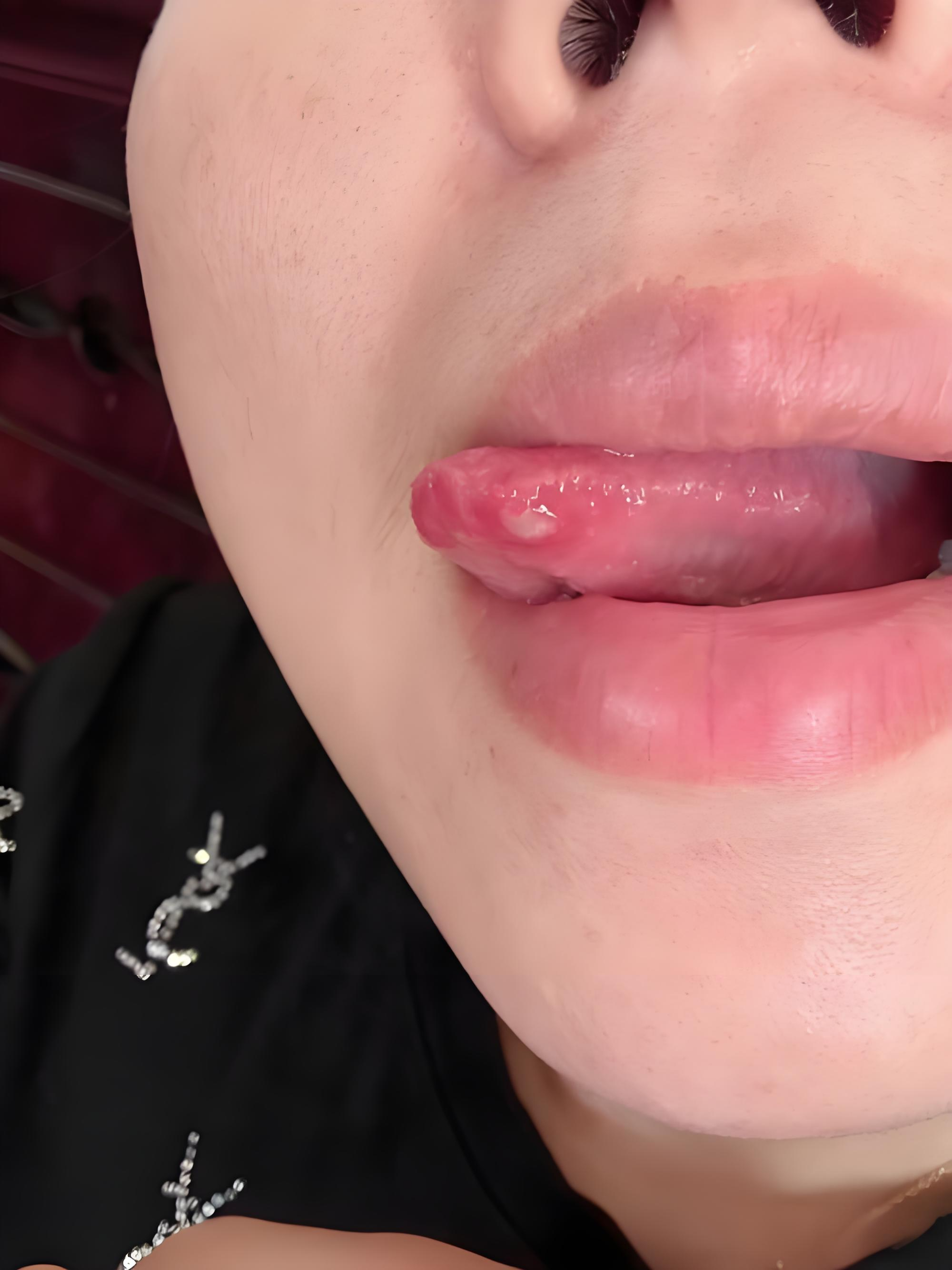 反复口腔溃疡,其实就是"身心失衡"了,能帮一个是一个