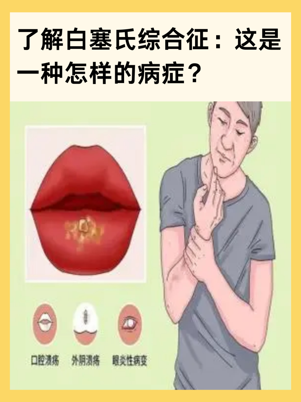 ⏩白塞氏综合征,一个在日常生活中不常被提及的疾病名称,却给患者