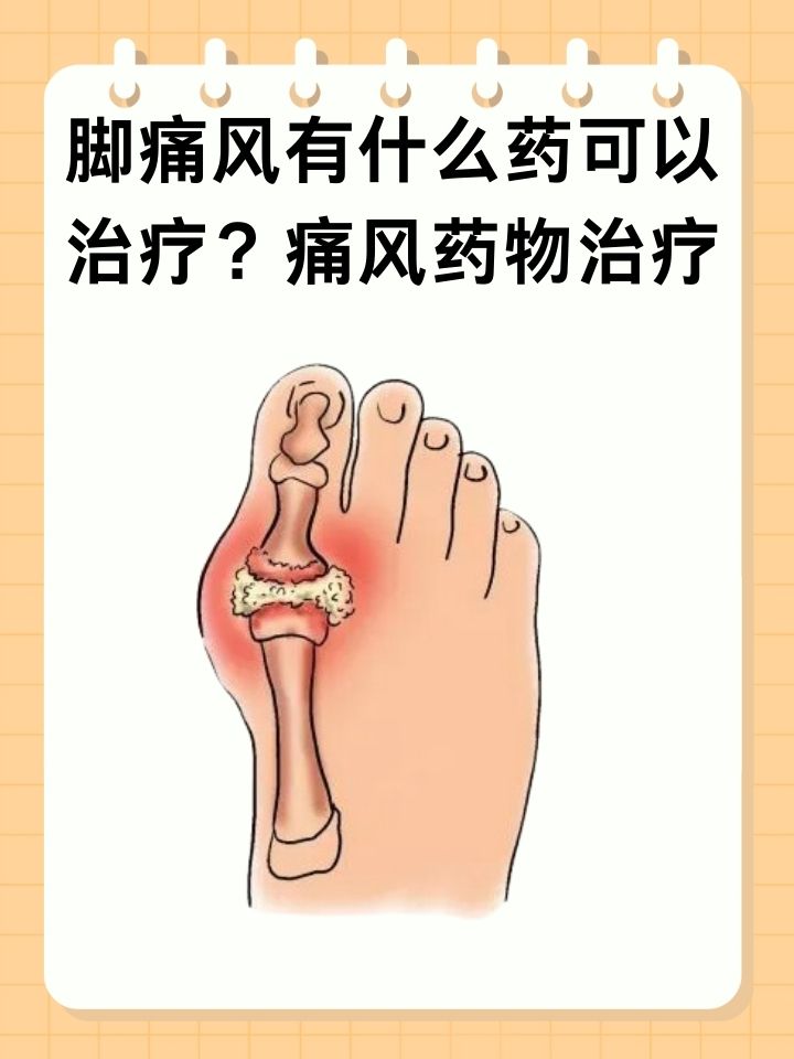 脚痛风这种由尿酸结晶沉积在关节引起的疾病,发作时
