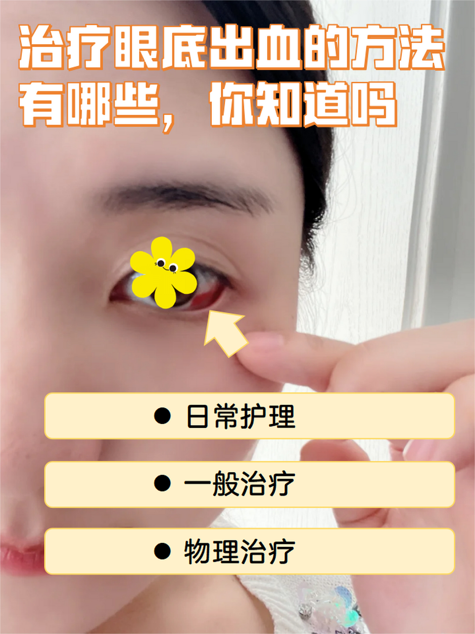 治疗眼底出血的方法有哪些,你知道吗 眼睛是我们身体的一个重要器官