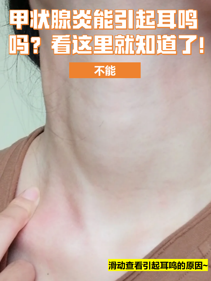 这是甲状腺的炎症性疾病,主要症状包括疼痛和肿大.