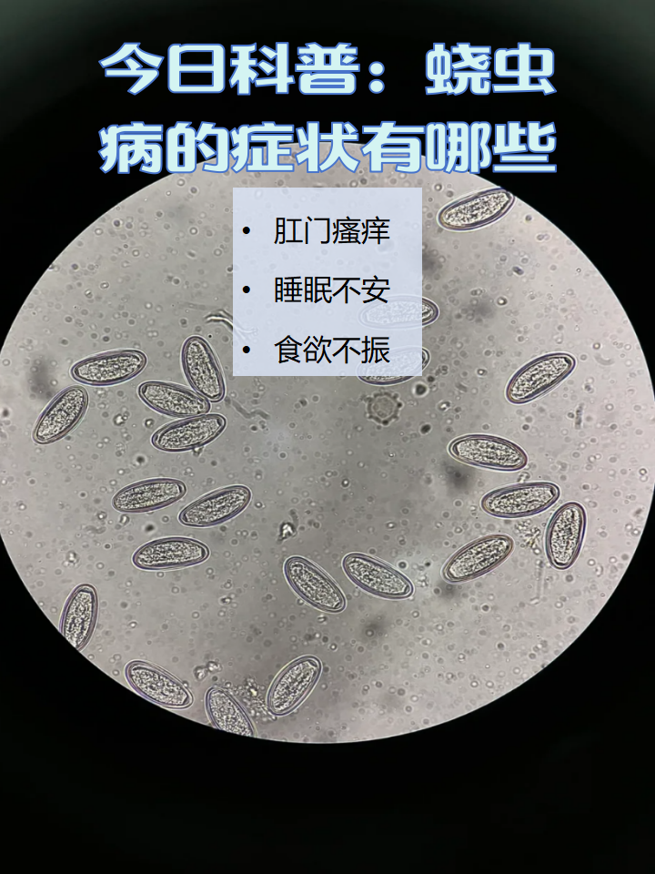 事实上,得了蛲虫病可能会出现肛门瘙痒,睡