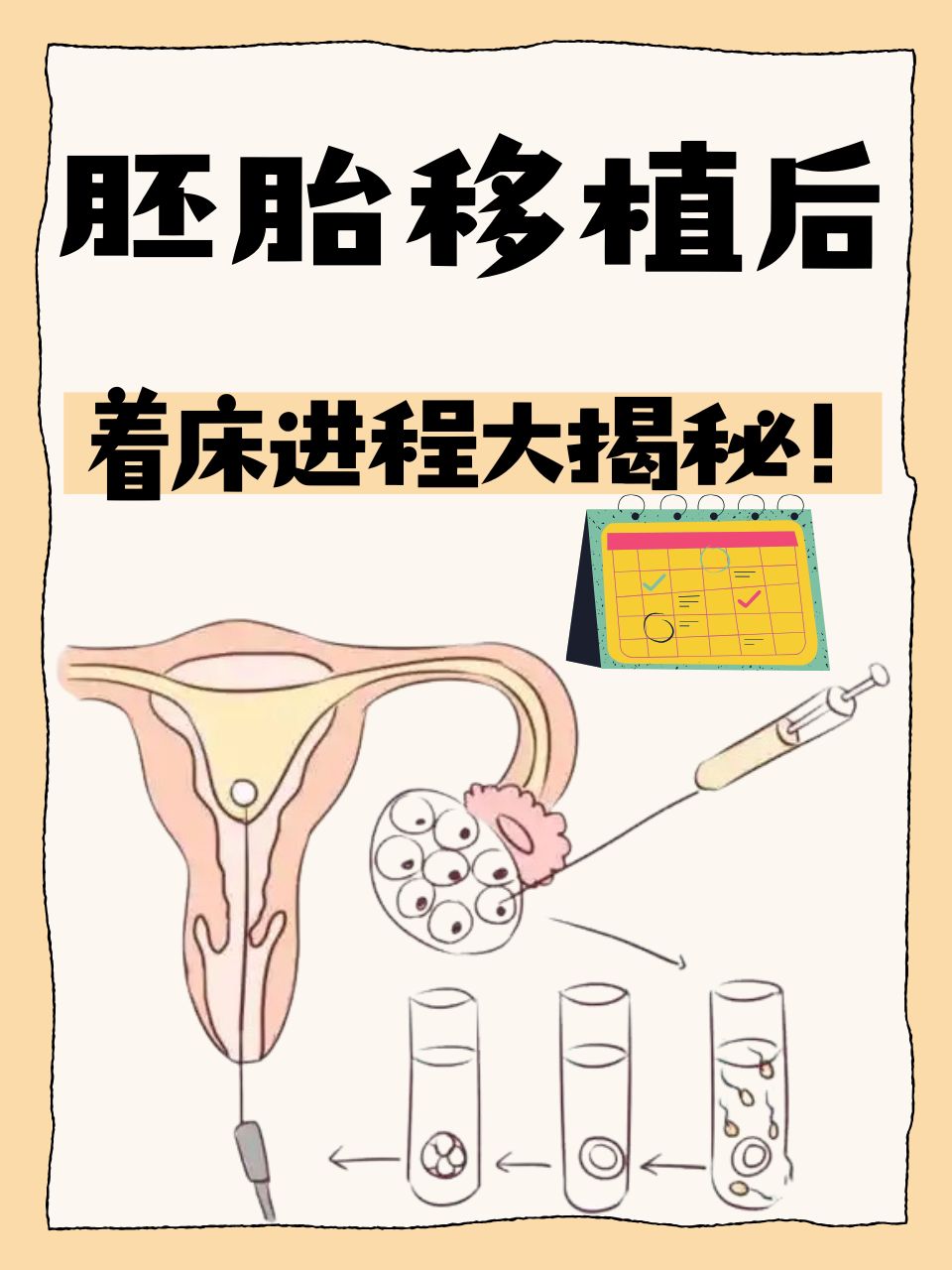 移植胚胎放在子宫什么位置_胚胎移植放的位置跟成功有关系吗  第2张