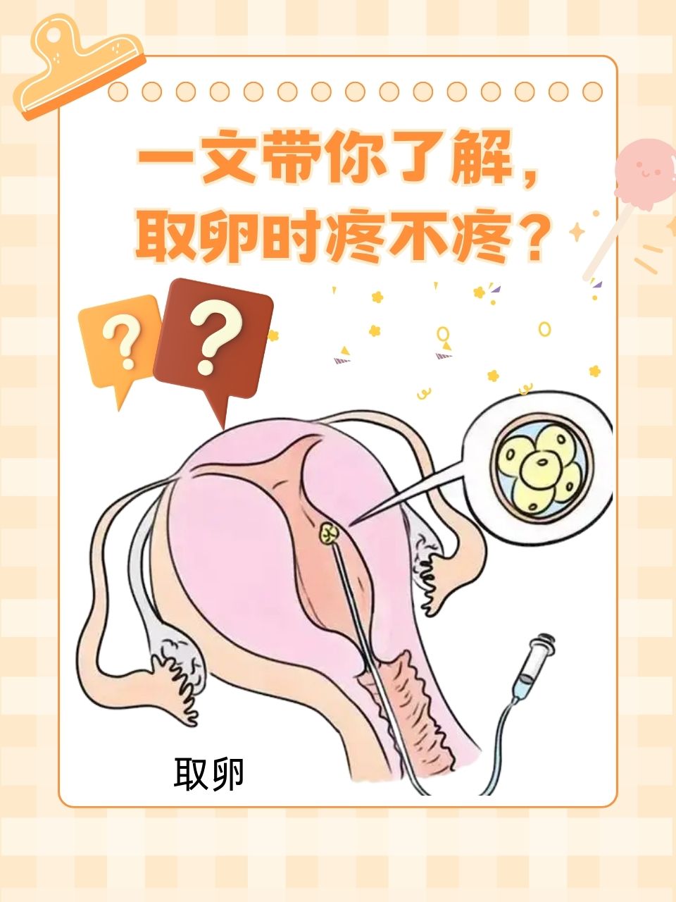 取卵不打麻药_取卵不打麻药是好事还是坏事  第2张