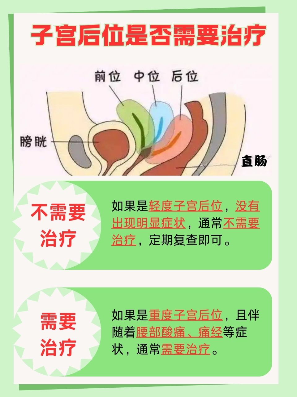很多女性在得知自己子宫后位时,都会心生疑虑:这是否意味着需要治疗?