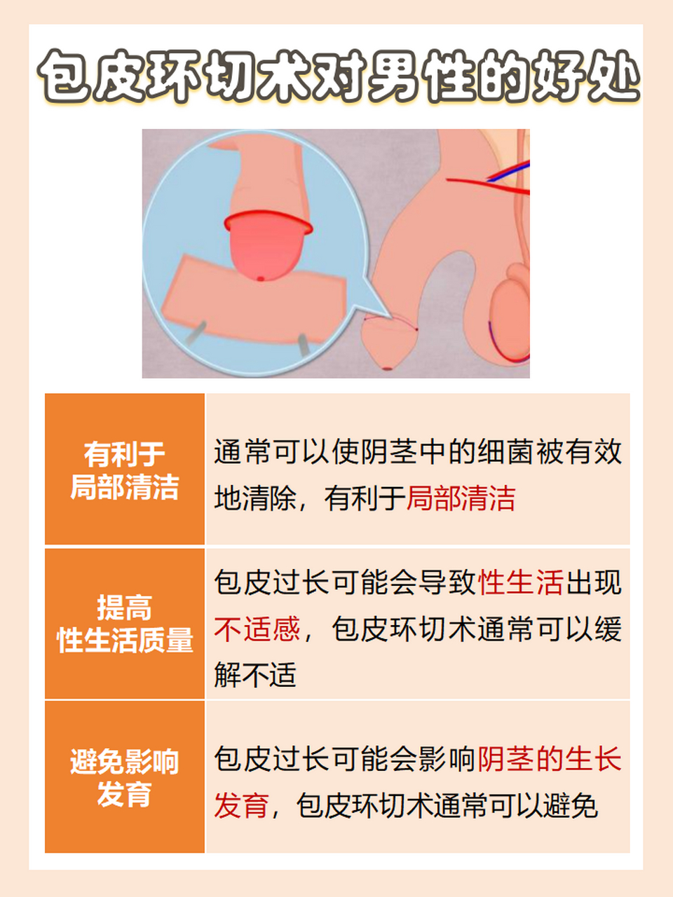 17岁包茎 好处图片