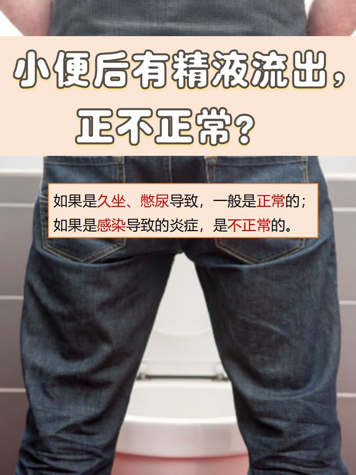 男性的小便与射精都需要尿道的参与,而且这两者一般不会同时出现[666]