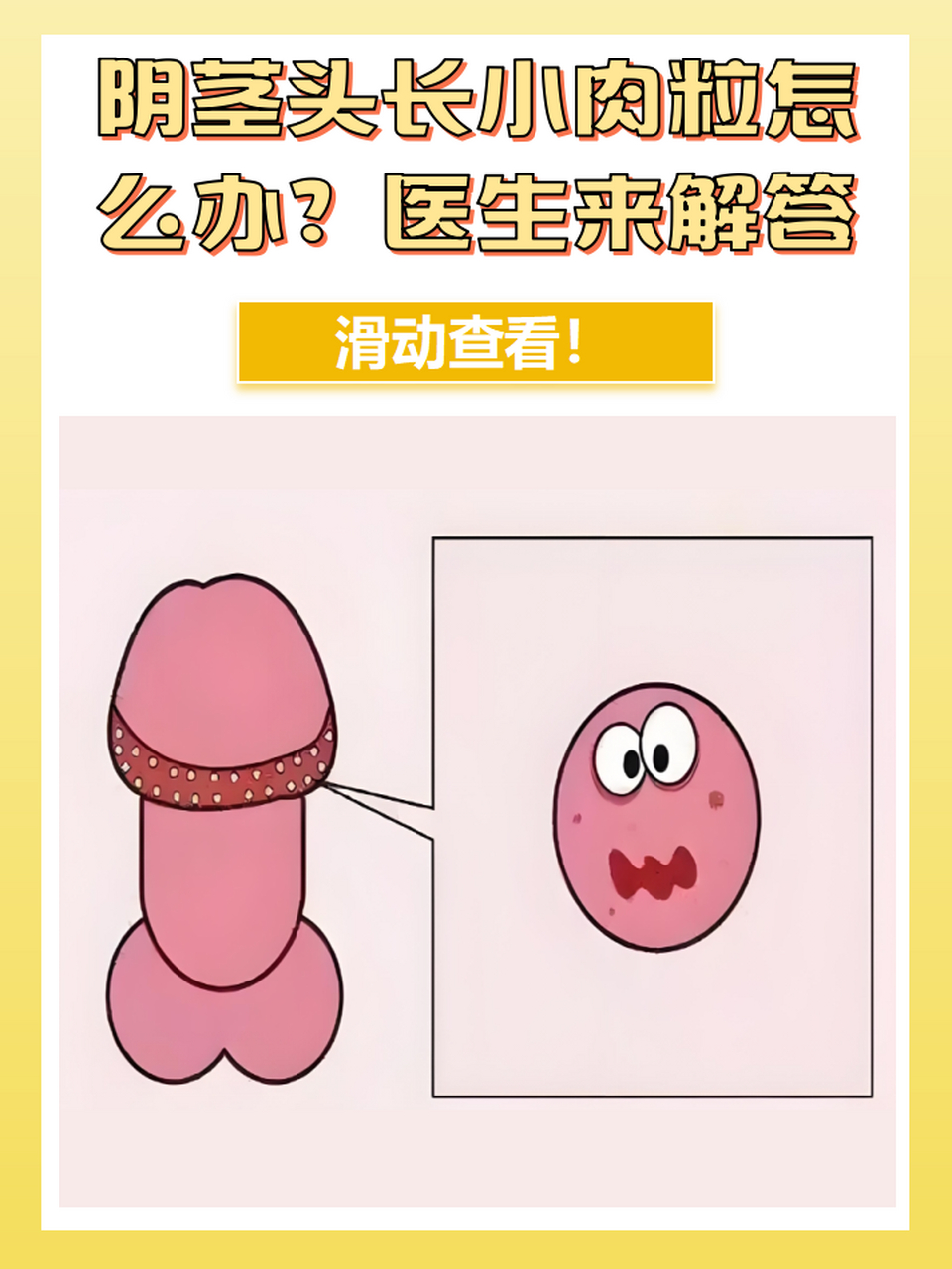 阴茎头长小肉粒怎么办?