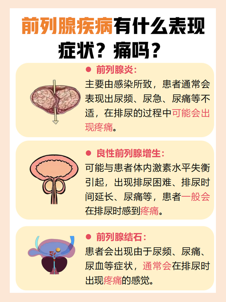 前列腺疾病有什么表现症状?痛吗?