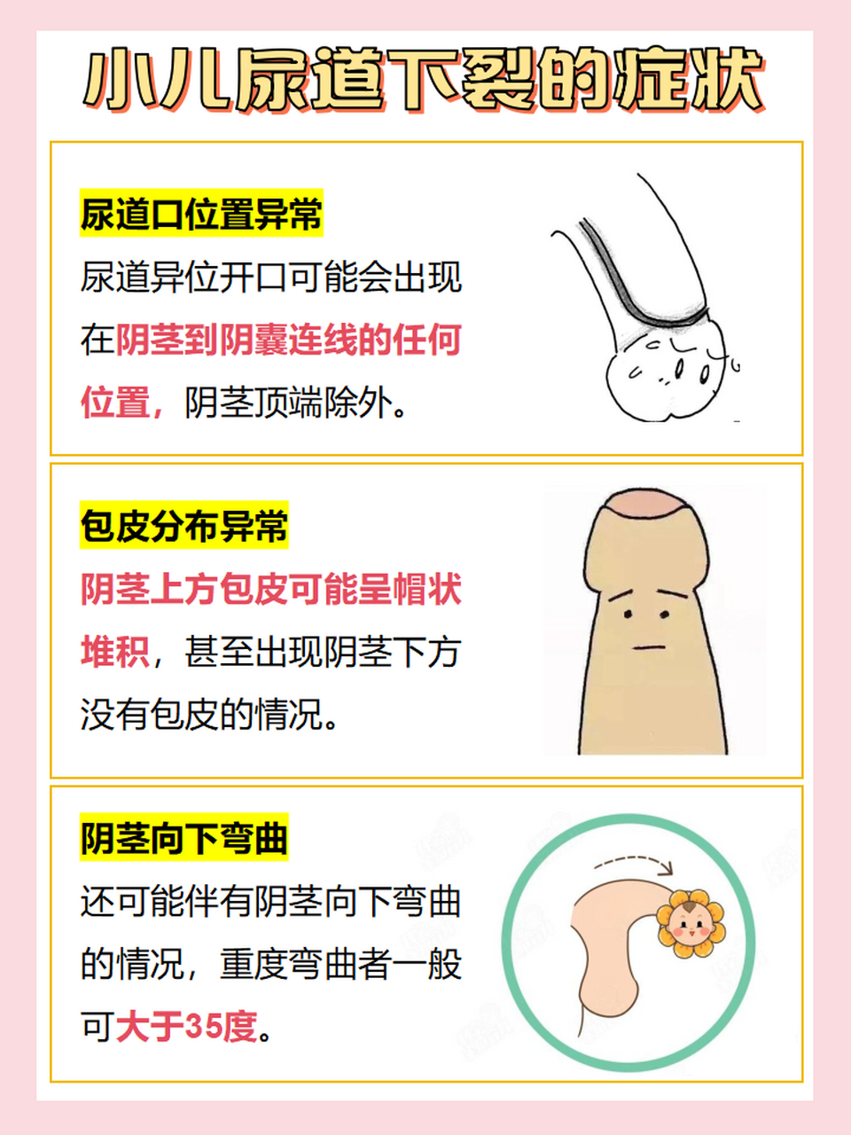男性的尿道通常具有排尿和排精的功能,如果在胚胎发育时期,尿道沟闭合