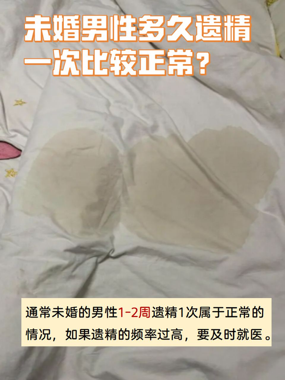 遗精是一种正常的生理现象,大部分男性在青少年时期都会出现遗精的