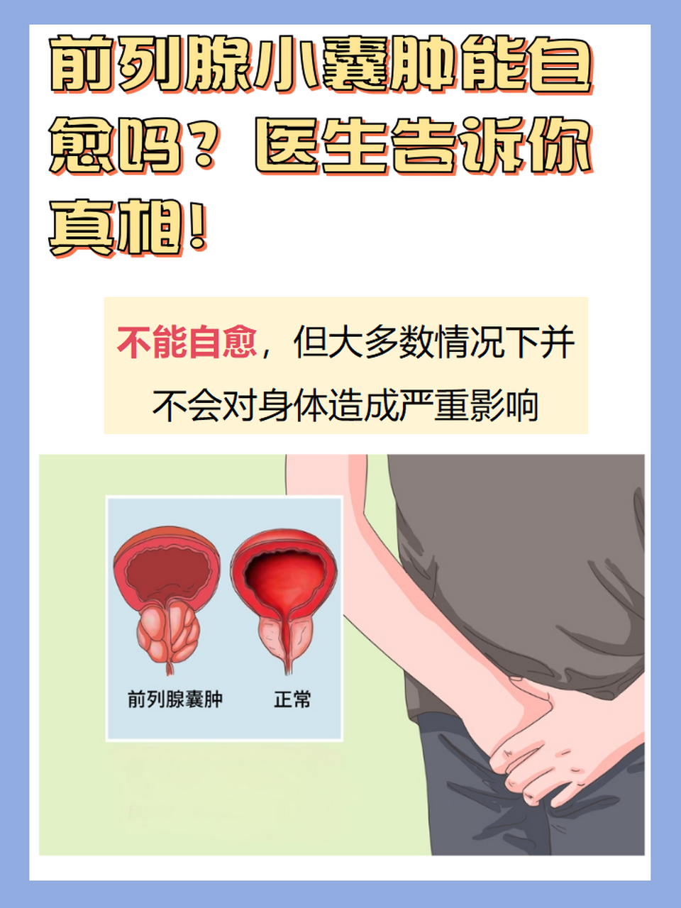 前列腺小囊肿就像是前列腺里长了个小水泡,一般是良性的,很多男性在