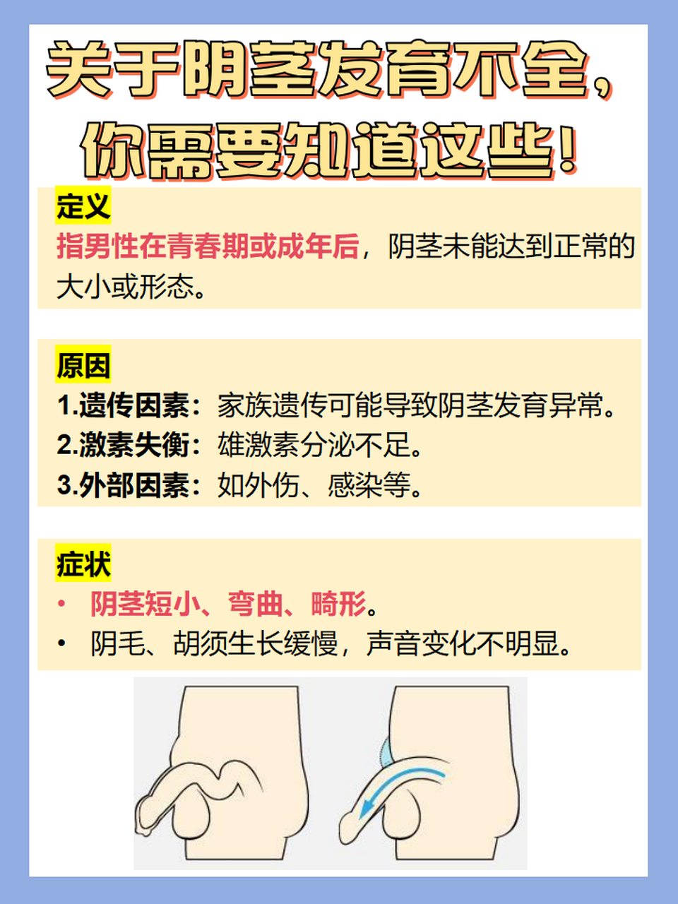 阴茎发育不良还能治吗?医生告诉你!